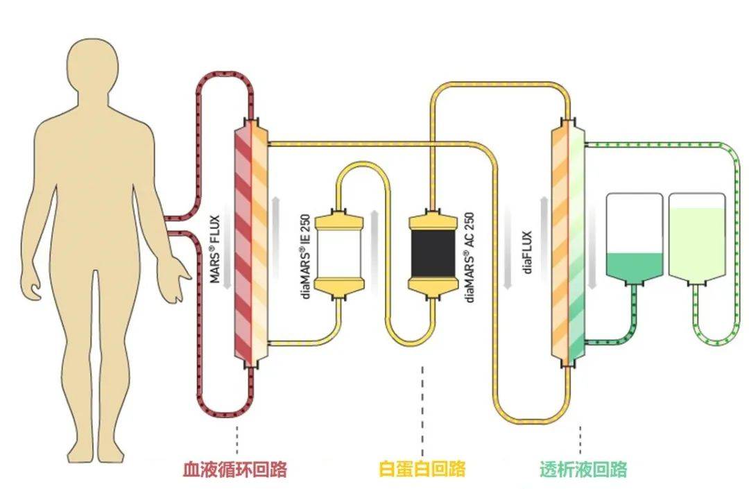 疫情中的救命神器“人工肝”，是怎样炼成的？